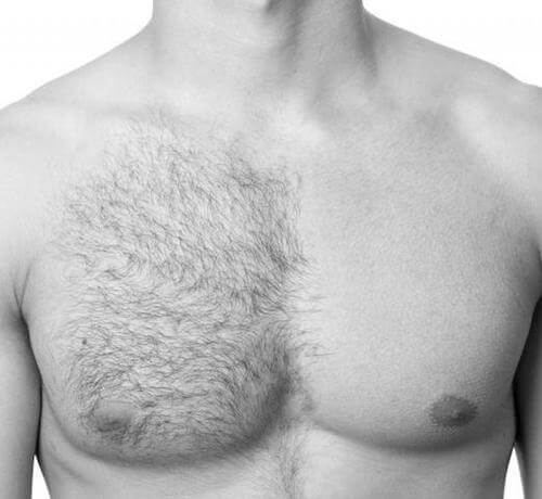 men hair removal Dubai